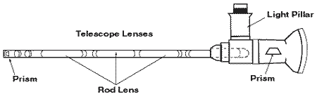 Side-view drawing of a cystoscope, a long tube-like instrument used to examine the inside of the bladder and urethra. Labels point to the telescope lenses, prism, rod lens, and light pillar.